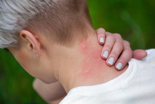 Differences Between Spider Bites And Mosquito Bites - MosquitoNix®