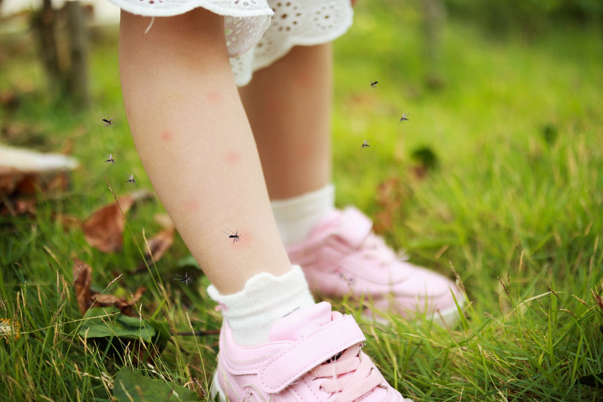 Treating Insect Bites: Home Remedies for Babies - MosquitoNix®